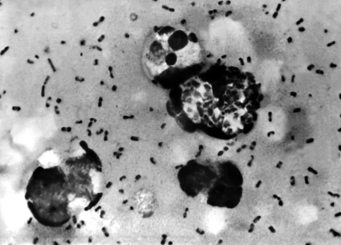 A bact&eacute;ria Iersina pestis, respons&aacute;vel pelos tipos de peste/Foto: Divulga&ccedil;&atilde;o